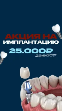 СЕЗОН ВЫГОДНЫХ УЛЫБОК В АРТ ДЕНТ